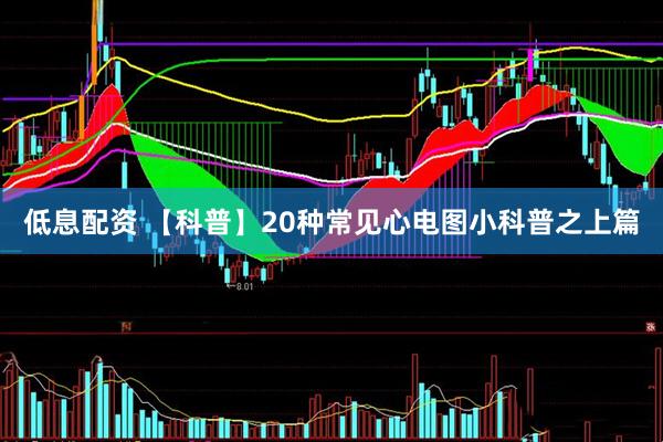 低息配资 【科普】20种常见心电图小科普之上篇